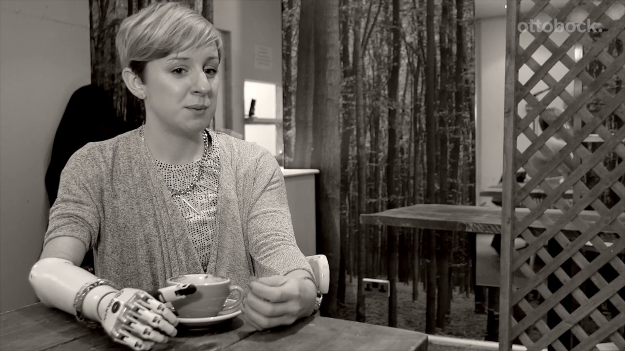 Nicky Ashwell: first UK bebionic small user tells her story