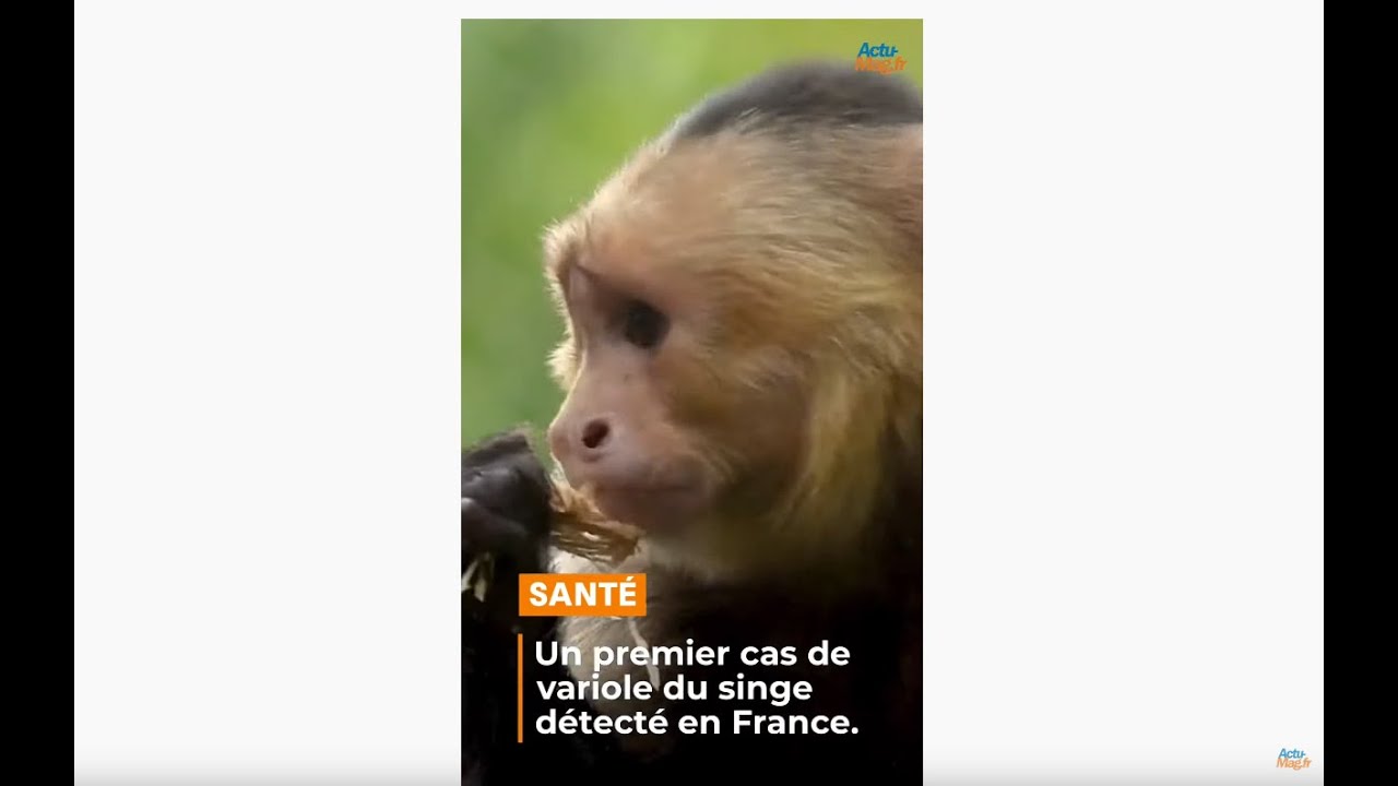 Un premier cas de Variole du singe « Monkeypox » détecté en Ile-de-France
