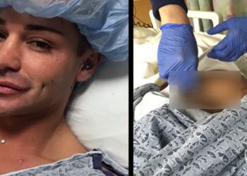 Il dépense plus de 50.000 euros pour avoir un corps parfait