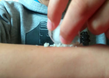 « L&rsquo;Ice and Salt Challenge » Le nouveau jeu très dangereux des ados sur les réseaux sociaux qu&rsquo;il faut bannir !