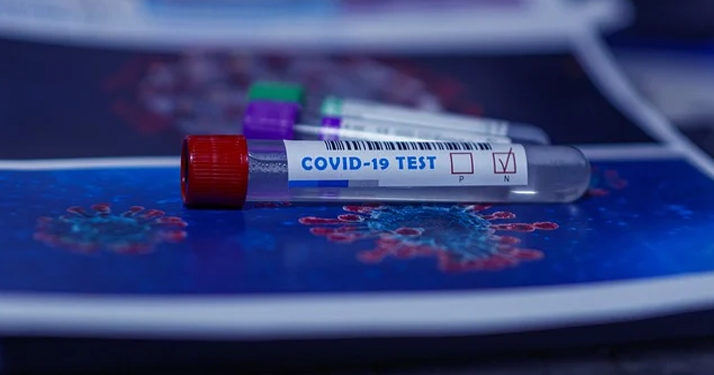 Coronavirus. 110 décès et 418 nouveaux cas en France au 20 mai