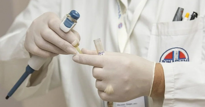 Covid-19 : Des chercheurs chinois ont identifié le virus dans le sperme de plusieurs patients