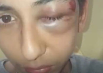 Bondy : Gabriel, 14 ans, raconte la violente interpellation dont il aurait été victime