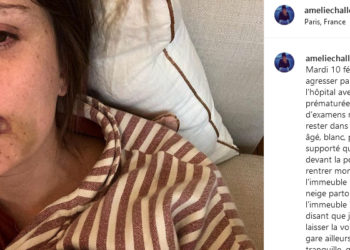 Paris. Le témoignage bouleversant d’une femme agressée devant son domicile alors qu’elle rentrait de la maternité