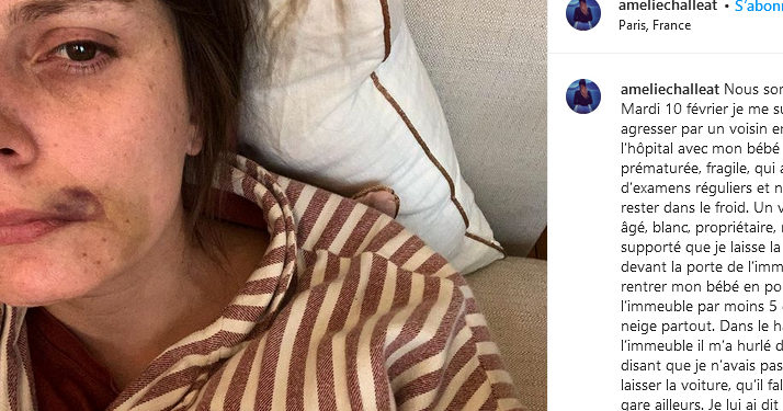 Paris. Le témoignage bouleversant d’une femme agressée devant son domicile alors qu’elle rentrait de la maternité