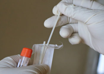 Covid-19. Dès ce week-end, tous les français non-vaccinés devront systématiquement présenter un test de moins de 24 heures pour revenir en France si ils se trouvent au Portugal ou en Espagne