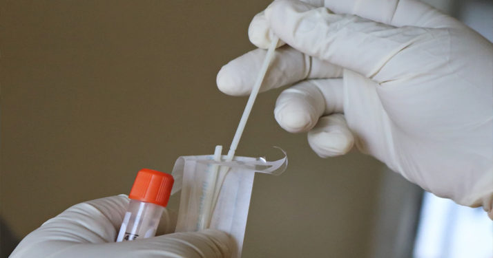 Covid-19. Dès ce week-end, tous les français non-vaccinés devront systématiquement présenter un test de moins de 24 heures pour revenir en France si ils se trouvent au Portugal ou en Espagne