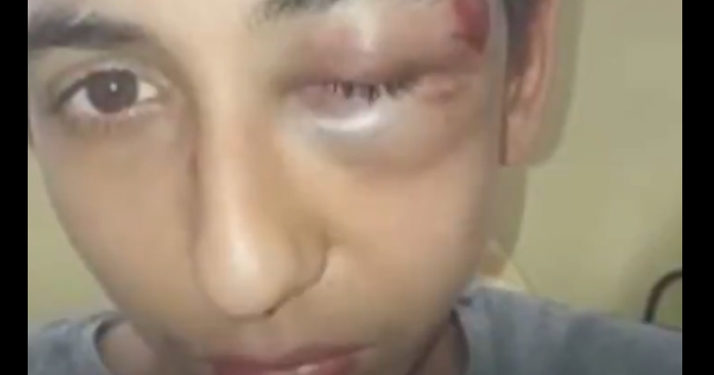 Bondy : Gabriel, 14 ans, raconte la violente interpellation dont il aurait été victime