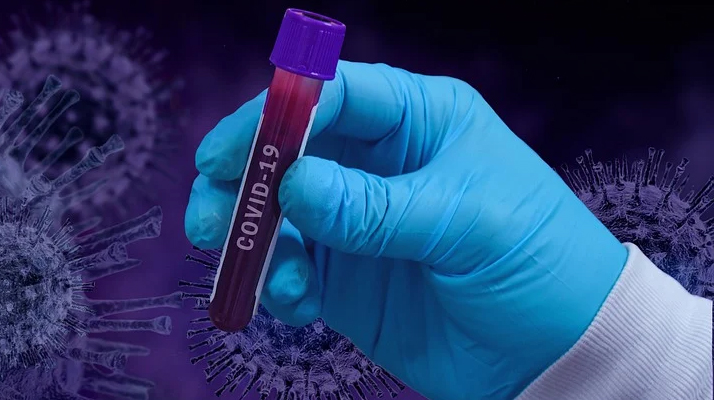 Coronavirus. + 4 771 nouveaux cas au 20 août. Emmanuel Macron confiant sur un vaccin dans « les prochains mois. »