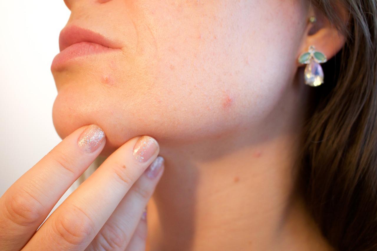 Le dermaplanning et ses bienfaits