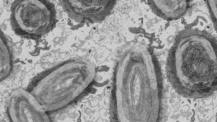 Variole du singe. 1955 cas recensés en France : neuf décès dans le monde