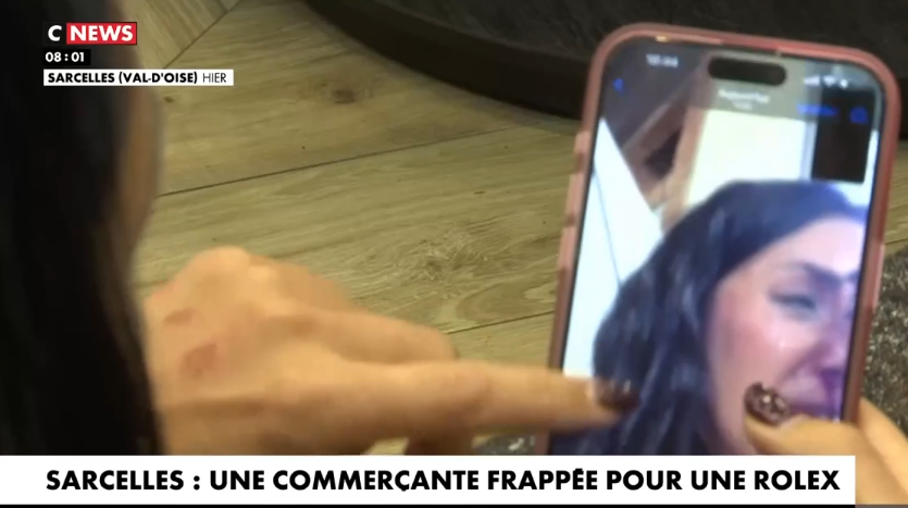 Sarcelles : Séverine, une commerçante de 44 ans violemment agressée à la sortie de son travail pour sa Rolex
