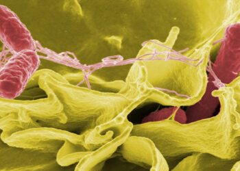 Escherichia coli dans l'Aisne