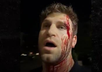 « J&rsquo;ai cru mourir » : Keegan Allen (Pretty Little Liars) violemment agressé et défiguré en pleine rue à Los Angeles